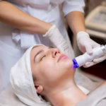 Best Acne Treatment Recommended by Dermatologists